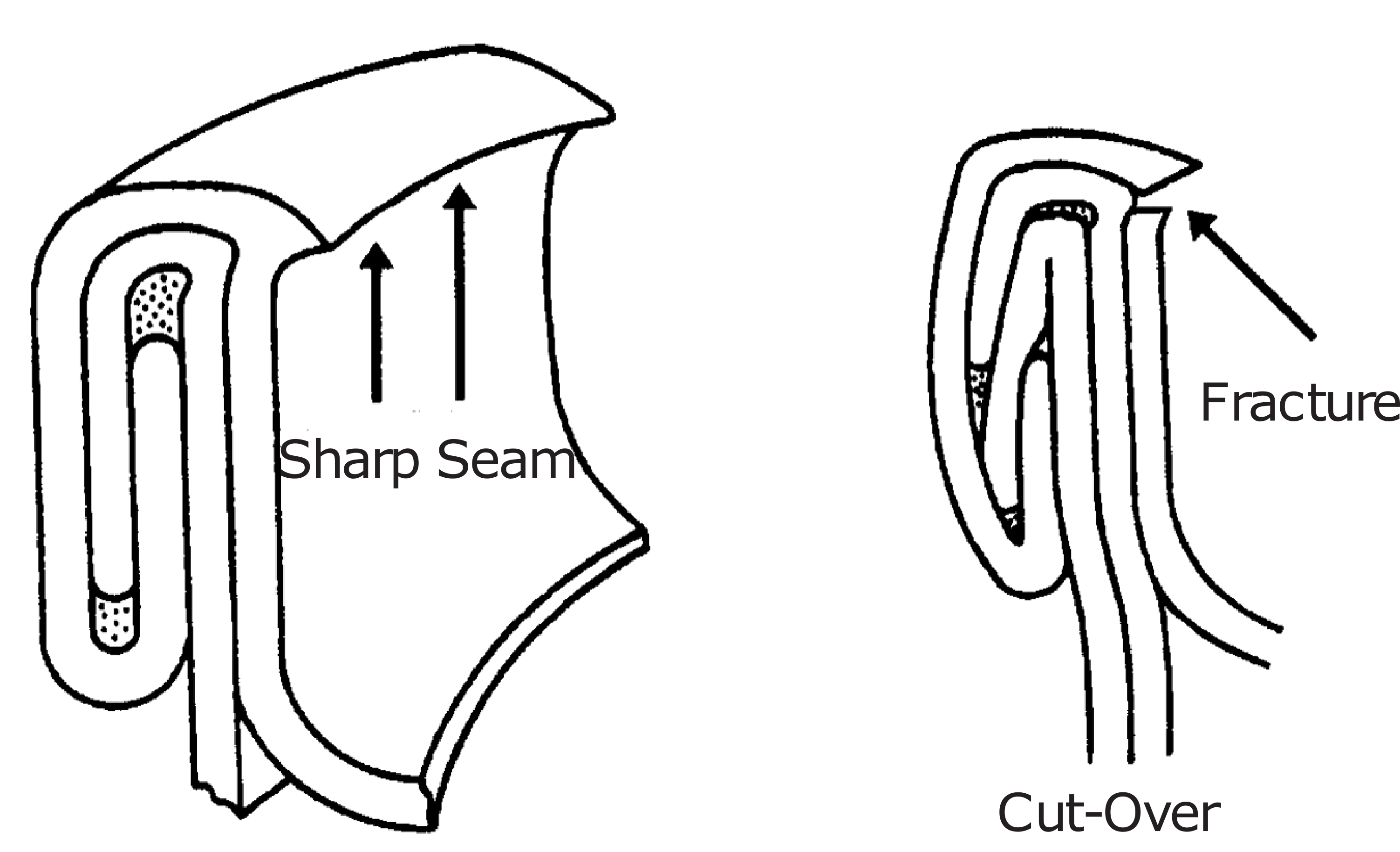 Seam labeled sharp seam and cut-over labeled fracture