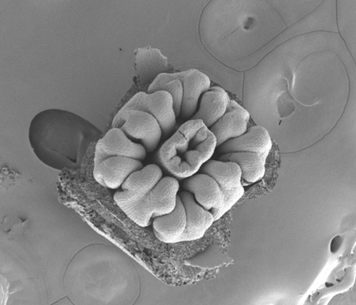 Photo by Pam Diggle.  This image from a scanning electron microscope reveals the details in a lowbush cranberry flower bud.